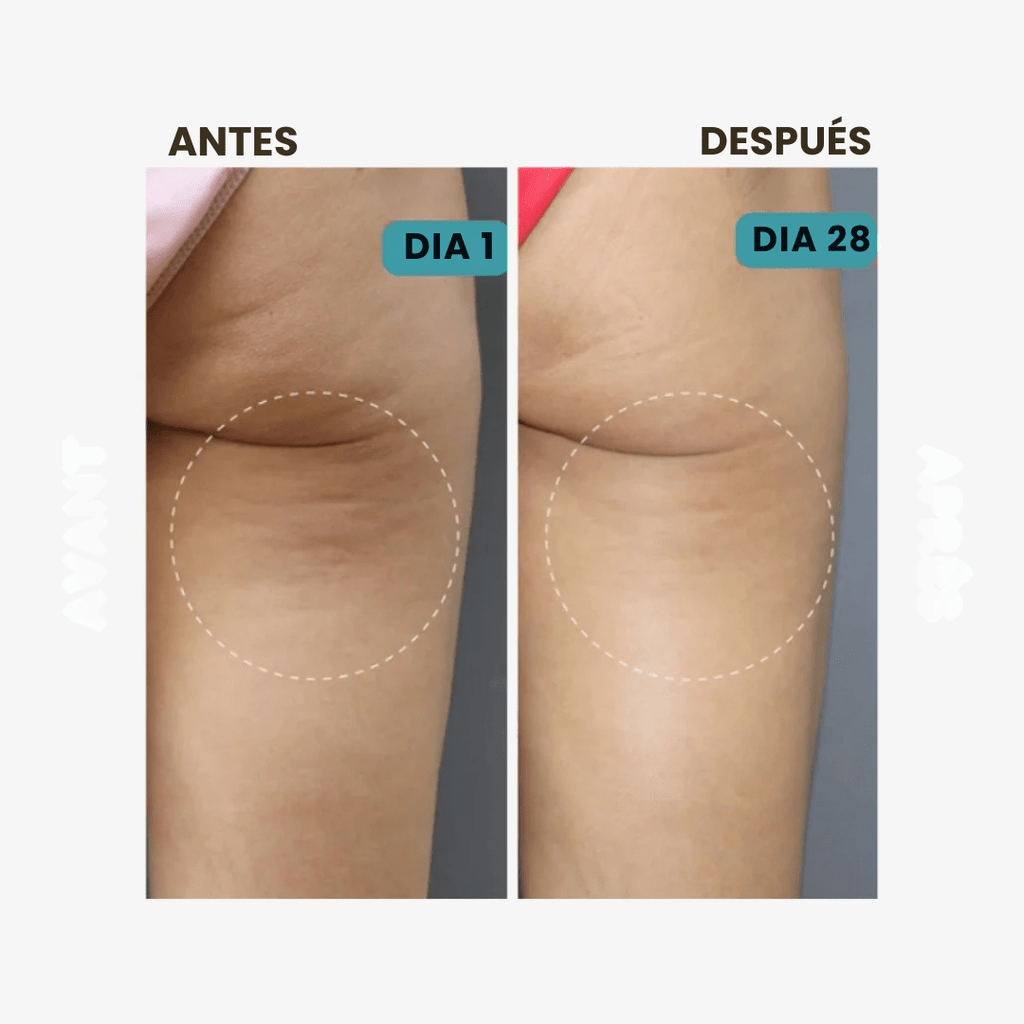 CelluFit™ – Compra 1 y 2 - Pantalones reductores anticelulitis