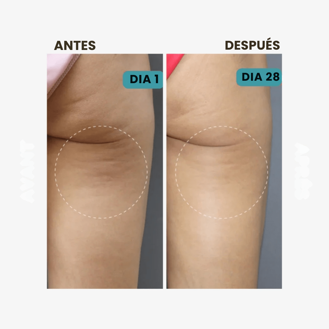 CelluFit™ – Compra 1 y 2 - Pantalones reductores anticelulitis
