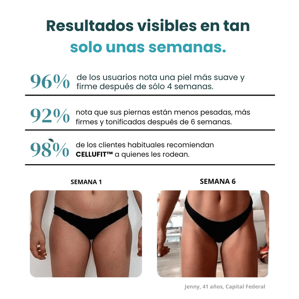 CelluFit™ – Compra 1 y 2 - Pantalones reductores anticelulitis